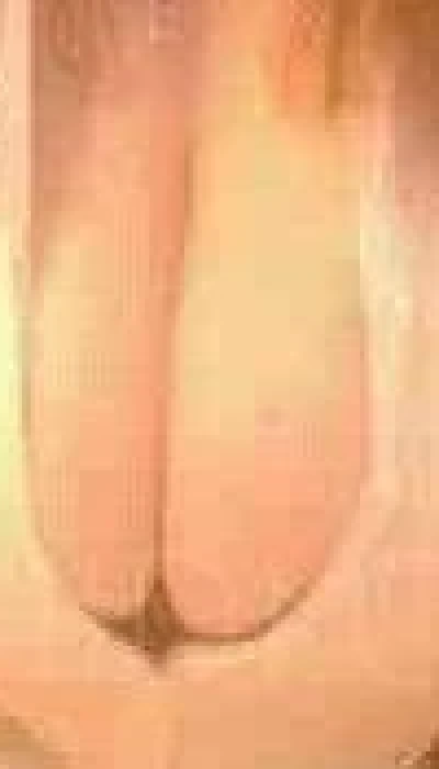 CurvaceousCaledonia
